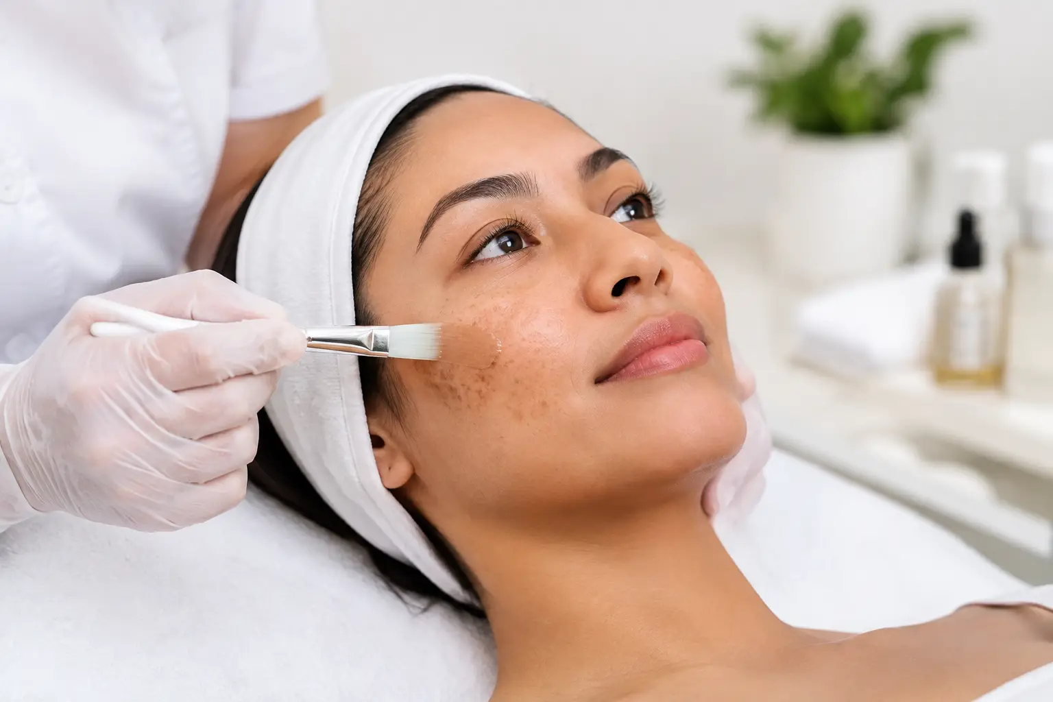 A Practical Guide to Hyperpigmentation Treatments
