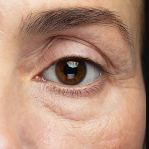 Eye Bag